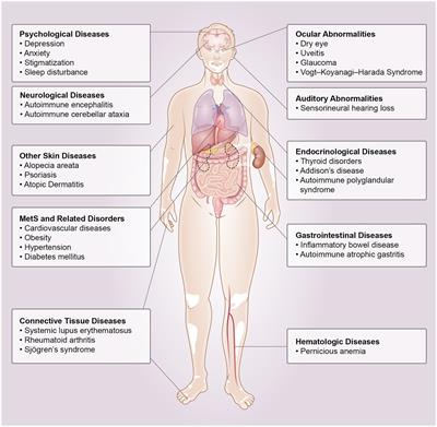 Beyond skin white spots: Vitiligo and associated comorbidities